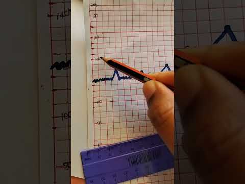 CTG interpretation part 3