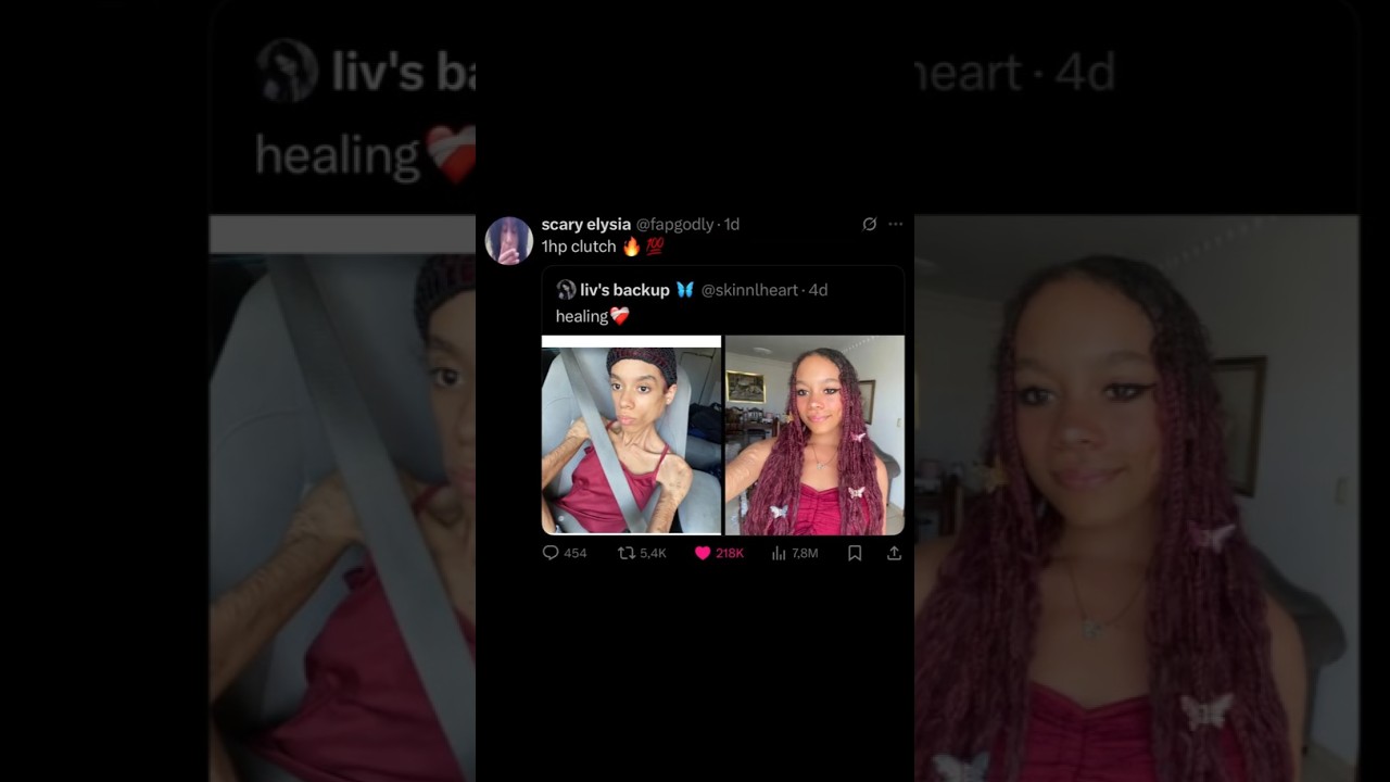 healing 💀💔 #humor #memes #funny #slideshow