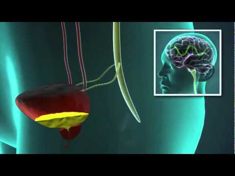 Nocno umokravanje * VAZOPRESIN