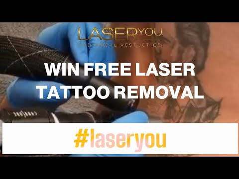 Win Free Tattoo Removal