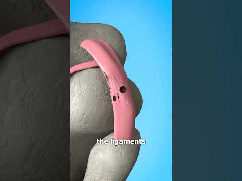 Hyperextending Your Knee? 😬 (explained)