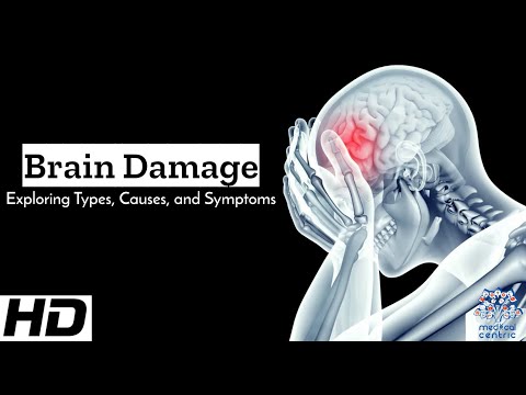 Brain Damage Decoded: Breaking Down Types, Causes, and Symptoms