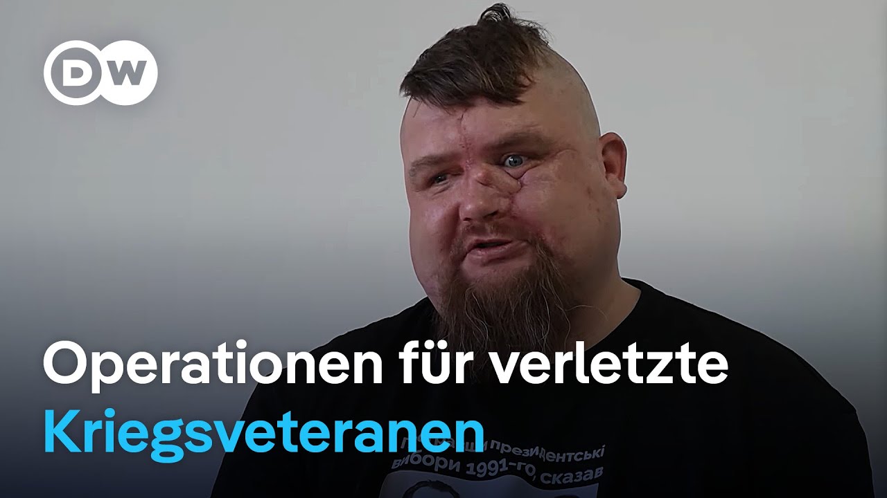 Ukraine: Ein neues Gesicht und ein neues Leben für Artem | DW Nachrichten