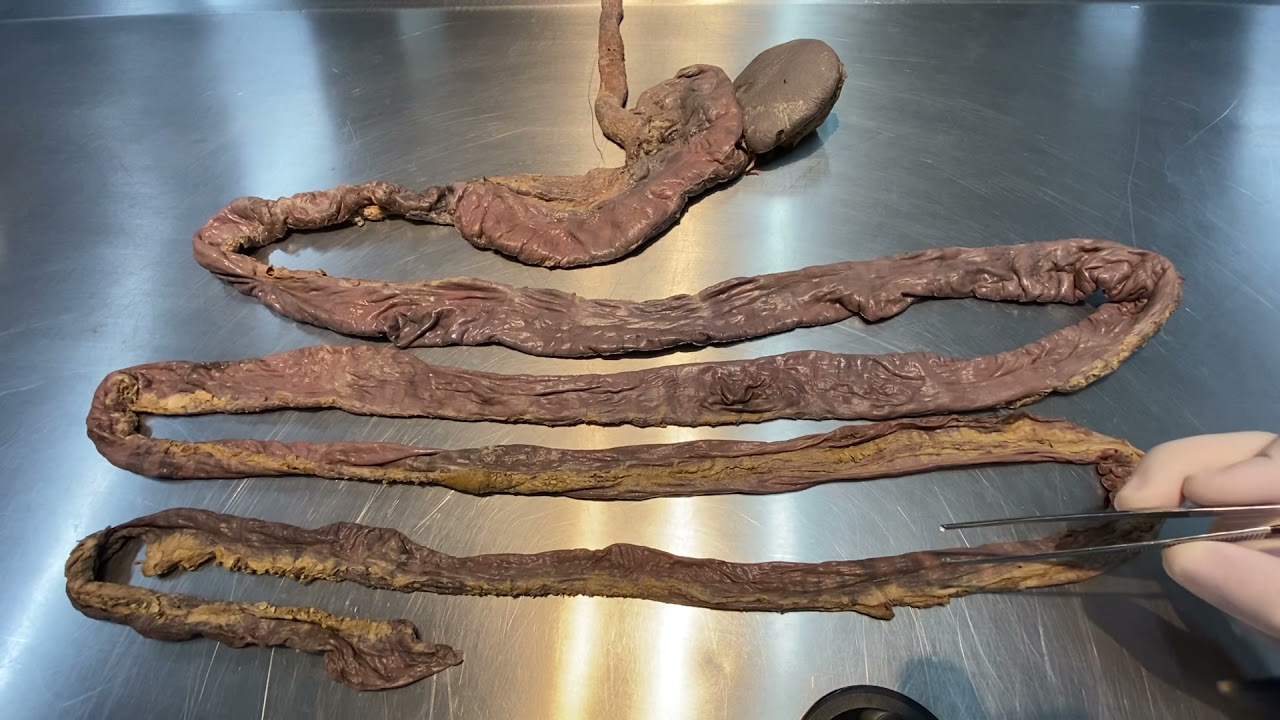 Anatomia do Intestino Delgado - aula prática de Anatomia (parte 01)