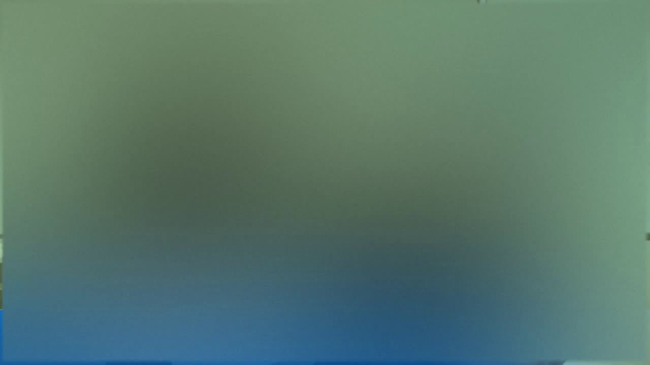 Thumbnail of video: Un médecin reconnait la guérison divine (16/11/15)