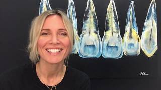 Myth: After a root canal you can&#39;t feel pain in the tooth