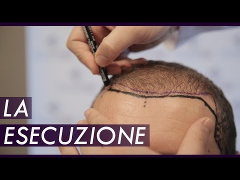Attivo significa per crescita di capelli Lava contro una perdita di capelli allatto di valutazione di risposte di donne