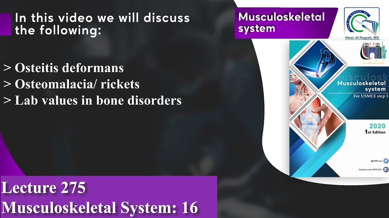 Osteitis deformans | Osteomalacia/ rickets | Lab values in bone disorders