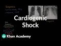 Cardiogenic shock | Circulatory System and Disease | NCLEX-RN | Khan Academy