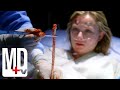 Removing a 25ft Tape Worm | House M.D. | MD TV