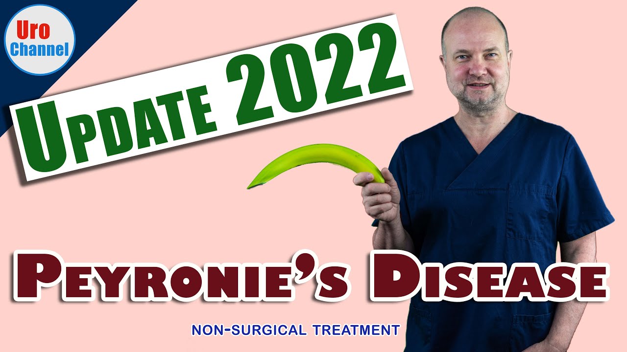 Shockwaves for Peyronie's disease and more 2022 | UroChannel