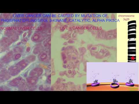 LIVER CANCER CAUSED BY MUTATION IN PIK3CA