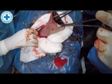 download lagu mp3 mp4 Cow Eating Plastic Bags, download lagu Cow Eating Plastic Bags gratis, unduh video klip Cow Eating Plastic Bags