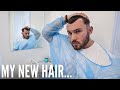 I GOT A HAIR TRANSPLANT | MY FULL SURGERY *GRAPHIC* EXPERIENCE... #hairtransplant #graphic #surgery