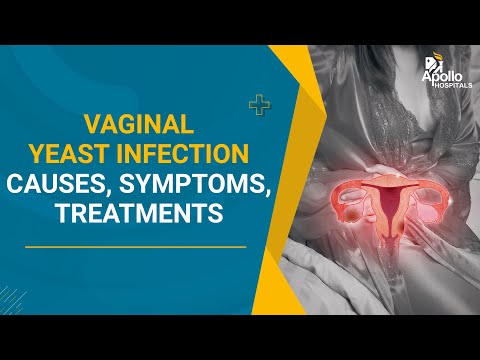 Vaginal Yeast Infection - Causes, Symptoms, Treatments & Prevention | Gynaecology | Dr Rooma Sinha