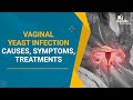 Vaginal Yeast Infection Causes Symptoms Treatments Prevention Gynaecology Dr Rooma Sinha