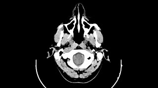 Case of the Day - 29 Nov 24