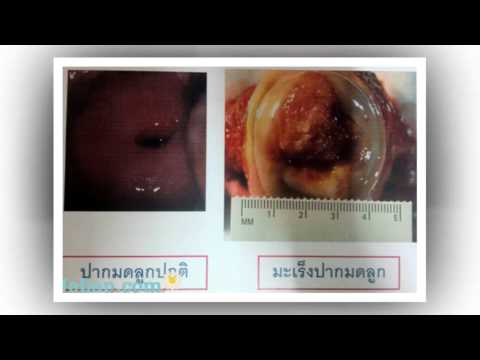 ยาราคาแรง ซื้อค้อนของ ธ อร์ใน Ivanovo