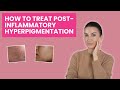 How To Treat Post Inflammatory Hyperpigmentation Dermatologist Explains Best Tips Products