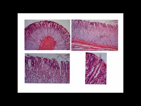 CORSO DI ISTOLOGIA LEZIONE 10 DI 30 EPITELI GHIANDOLARI PARTE 4
