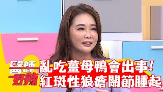 亂進補會出事？「紅斑性狼瘡」患者吃薑母鴨關節腫起？！【#醫師好辣】20221123 part3 EP1454 趙函穎 劉怡里
