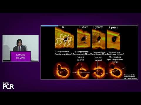 Next generation balloon expandable TAVR and thin strut BRS - Science and clinical update - EuroPCR