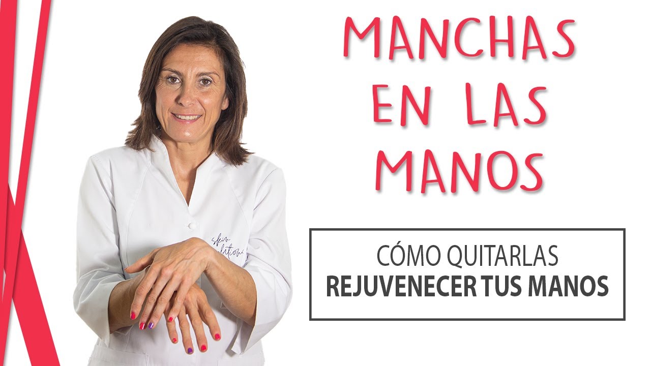 Manchas en las Manos Por qué Salen - Tratamiento para REJUVENECER las Manos