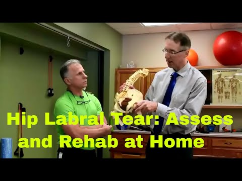 Hip Labrum Tear- How to Assess & Rehab at Home Video