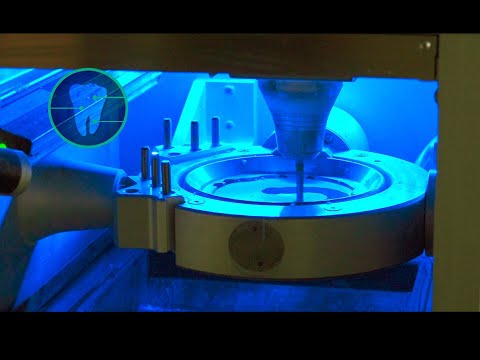 Digitale Fertigung einer adjustierten Aufbissschiene in der Zahntechnik