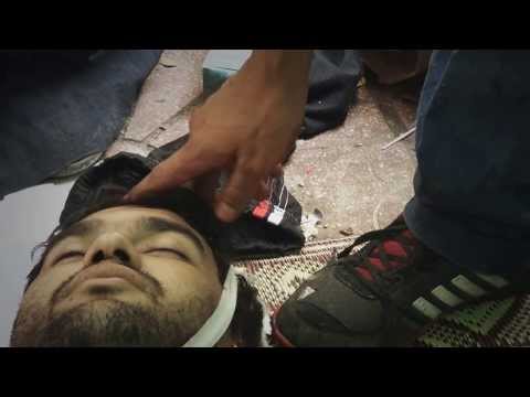 مذبحة الفض : توثيق مجازر الانقلابيين .. مشاهد متفرقة من مجزرة فض اعتصام رابعة العدوية