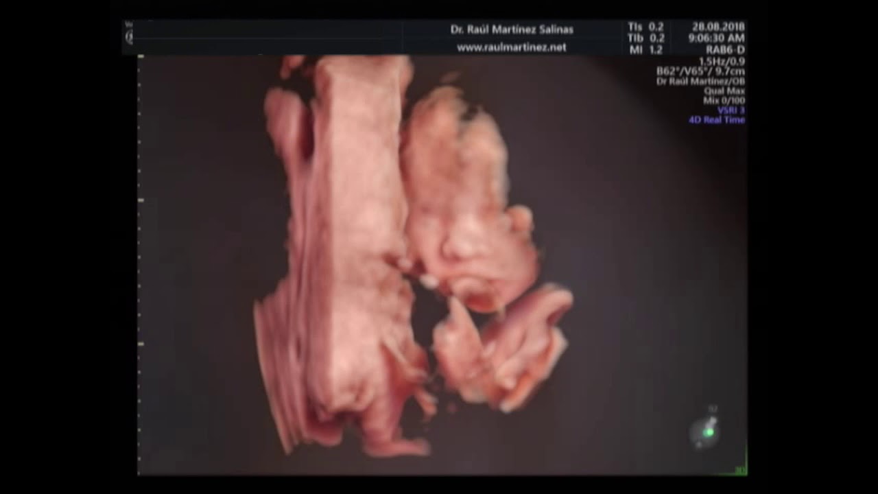 Raúl Martínez Salinas-8