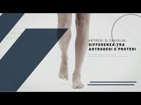 Perché i dolori cardiaci e ritorno Il mezzo migliore per le articolazioni in bodybuilding