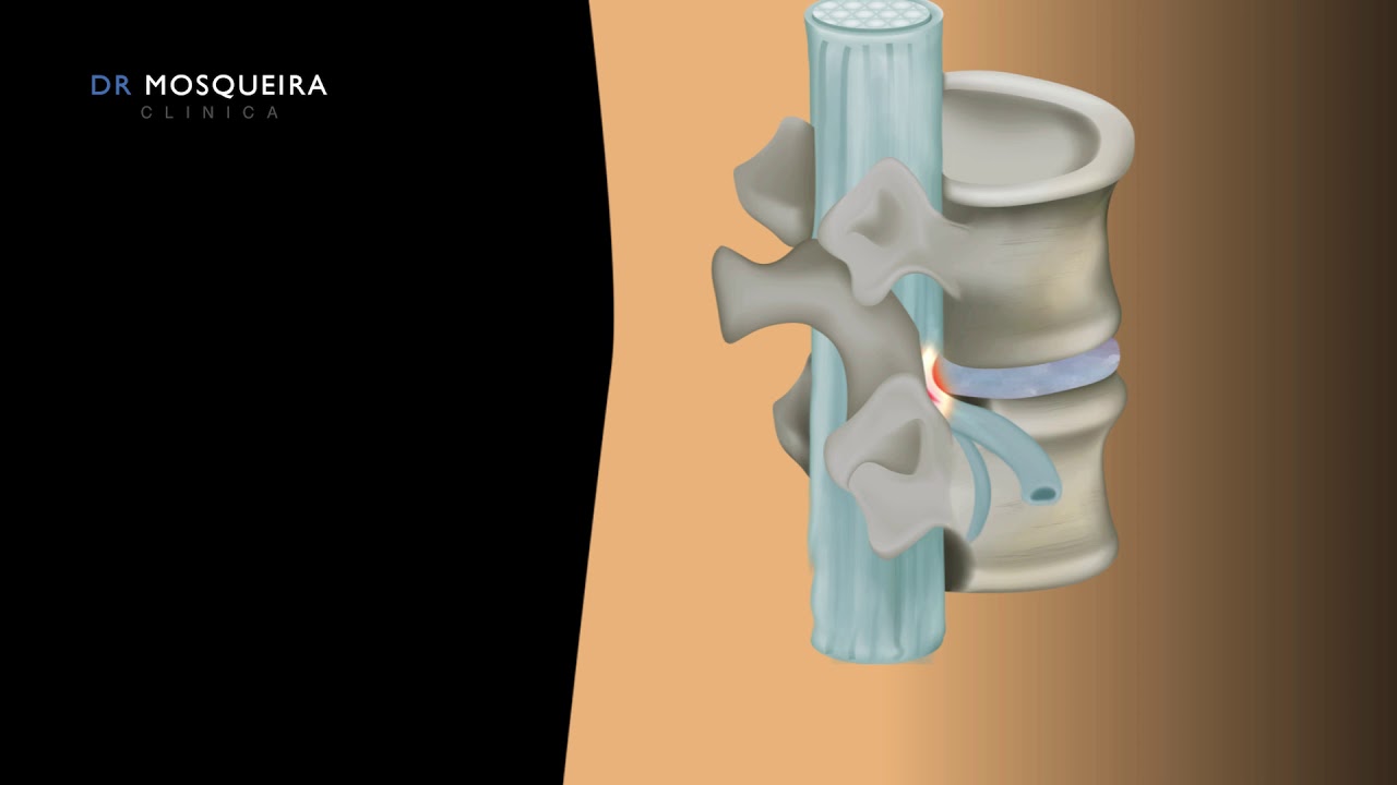 Bernardo Mosqueira Centurión-11