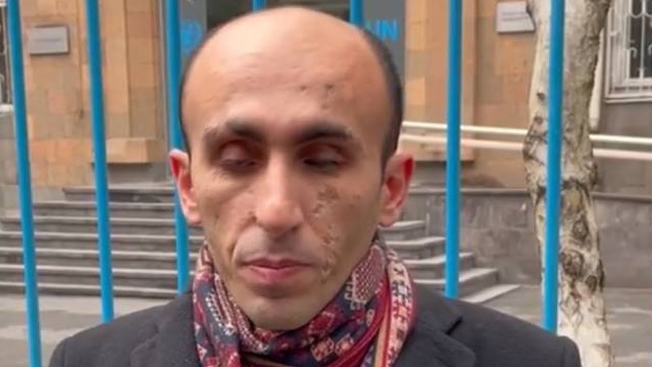 #Հիմա․ Արտակ Բեգլարյանի ասուլիսը ՄԱԿ-ի գրասենյակի դիմաց․ ուղիղ