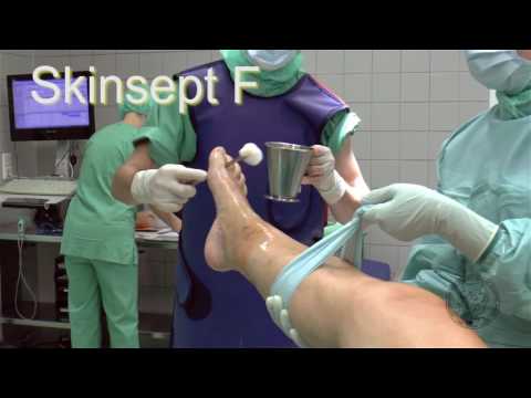 Ich bin 17 und ich habe Prostatitis Prostatitis kann begreifen