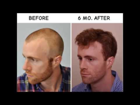 Testimonials – Anderson Center for Hair in Alpharetta & Atlanta, GA Testimonials – Anderson Center for Hair in Alpharetta & Atlanta, GA