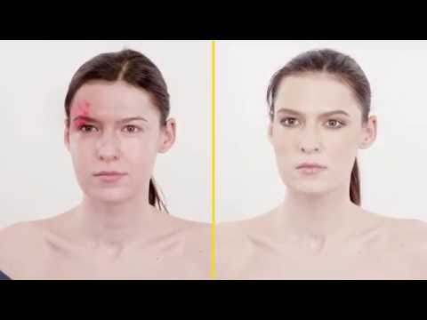 Come coprire angioma - RiparCover Camouflage