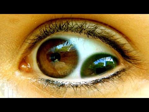 10 People with The Most Unusual Eyes