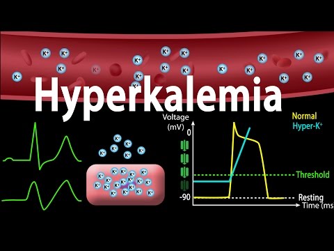 Hyperkalemia: Causes, Effects on the Heart, Pathophysiology, Treatment, Animation.