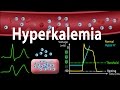 Hyperkalemia Causes Effects On The Heart Pathophysiology Treatment Animation