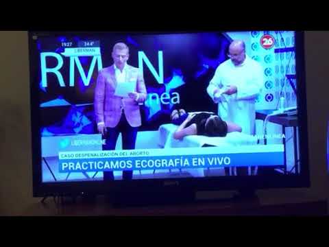 ECOGRAFIA EN VIVO Muestra Vida pese a corto tiempo