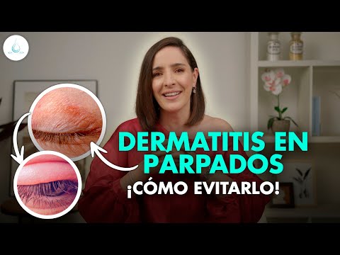 🔴 Eyelid dermatitis: What is it and how is it treated? @drapilarochoa - Dermatologist