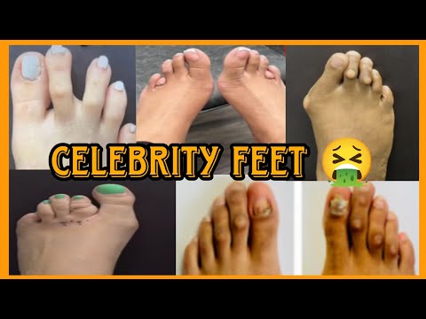 WHY CELEBRITIES ARE REVEALING THEIR UGLY FEET  🤔😱