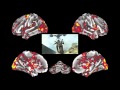 The RUIN Ed Brain