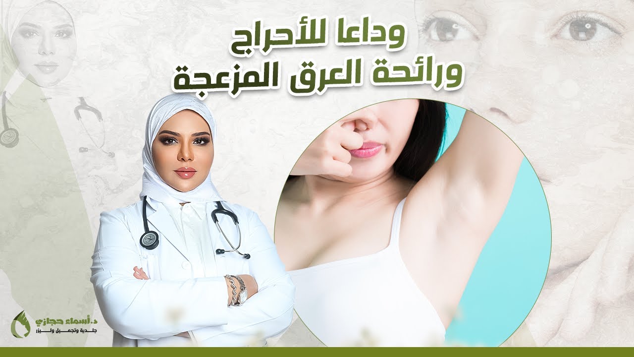 علاج فرط التعرق الزائد بإجراء واحد  | دكتور اسماء حجازي