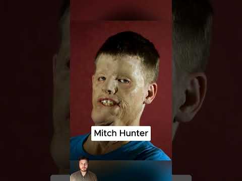 Soldiers Before And After The War 😮