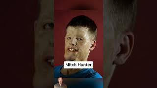 Soldiers Before And After The War 😮