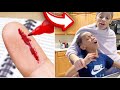 KD SLICED HIS FINGER PRANK ON SISTERS!