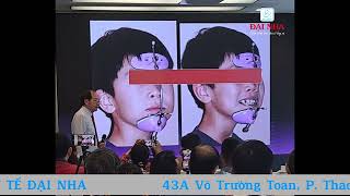 Chỉnh Nha Nâng Cao: Điều Trị Hẹp Ngang Hàm Trên, Hàm Trên Kém Phát Triển và Cắn Chéo Hạng 3