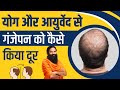 78 की उम्र में योग और आयुर्वेद से गंजेपन